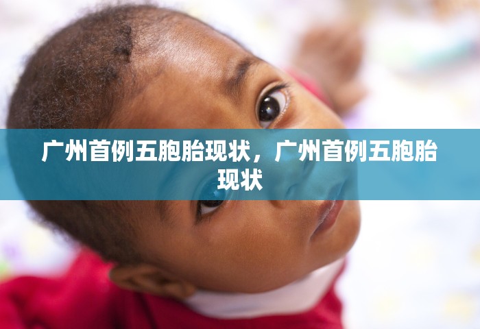 广州首例五胞胎现状，广州首例五胞胎现状